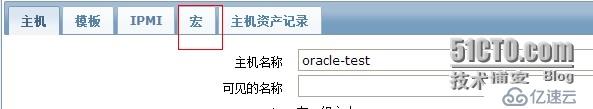 zabbix中如何监控oracle