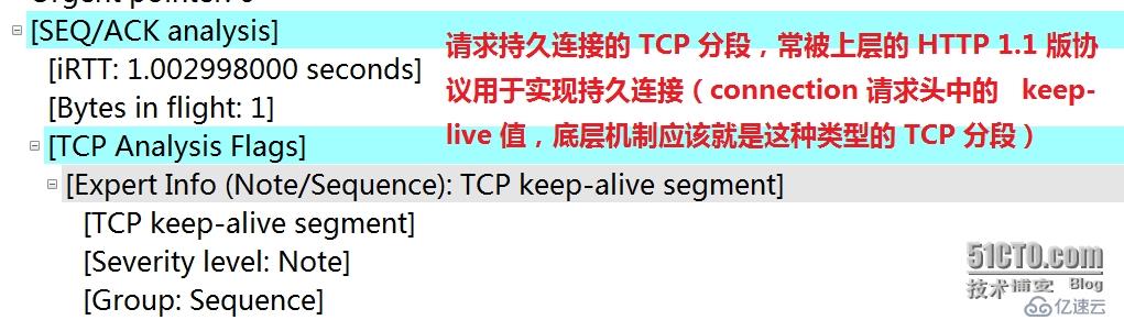 TcpIP协议,HTTP,DNS 实战:基于wireshark与BurpSuite抓包分析