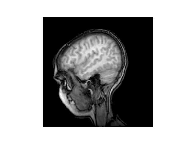 Python如何读取MRI并显示为灰度图像