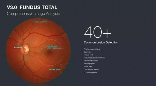 一眼万年：AI眼底筛查为什么能够成为AI医疗中的“落地之王”