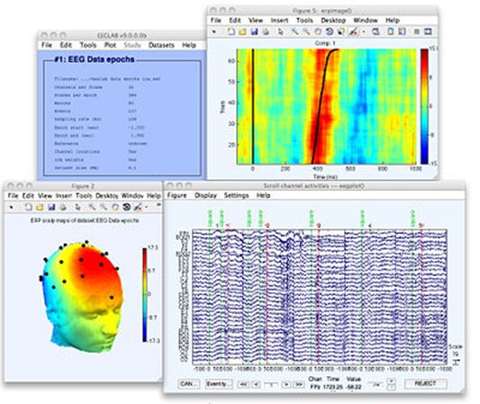 EEG/MEG处理分析软件都有哪些