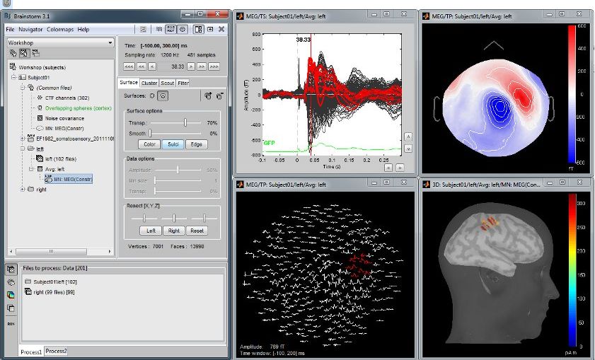 EEG/MEG处理分析软件都有哪些