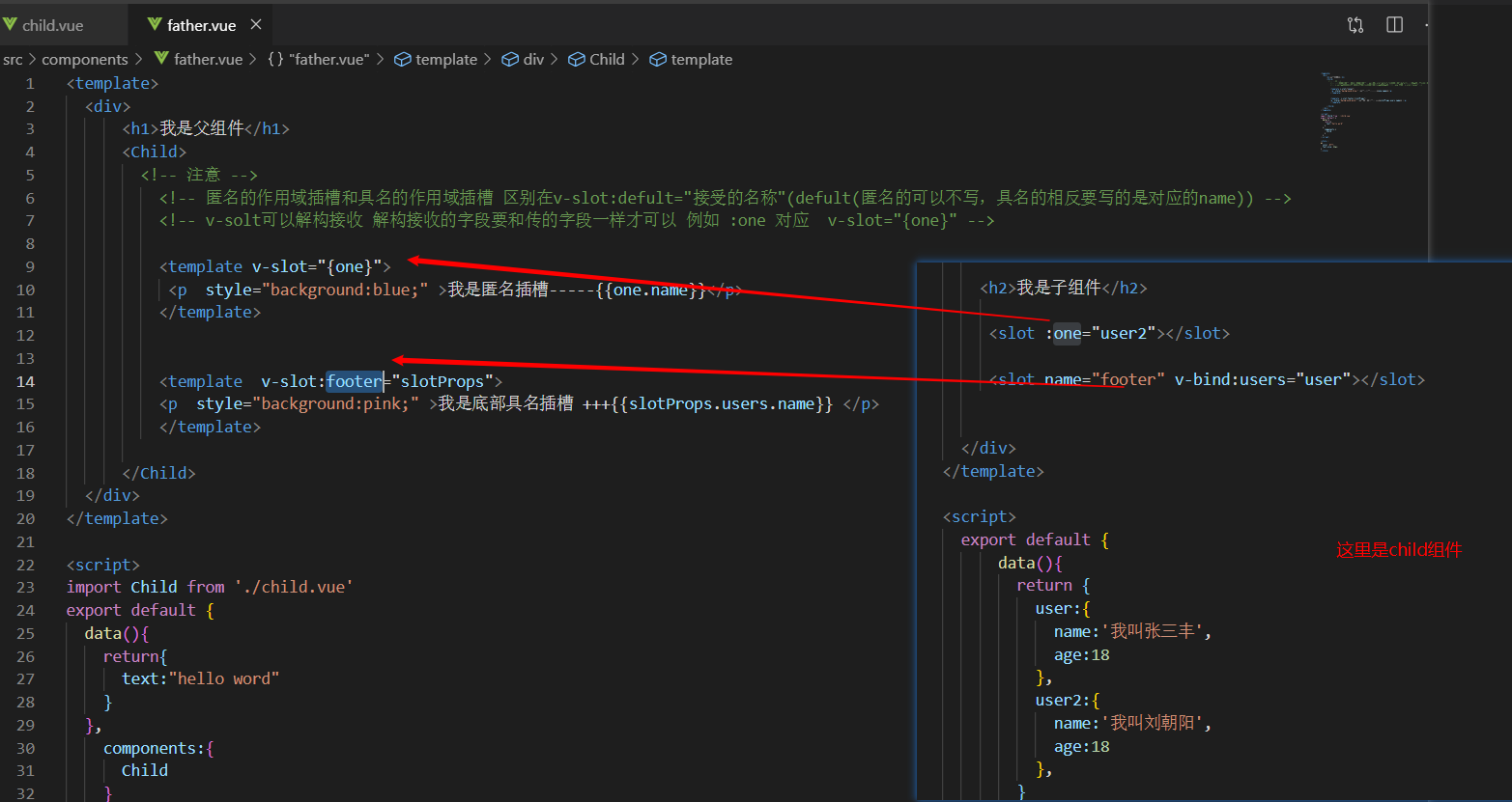 Vue中插槽slot有什么用