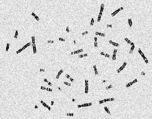 Python如何实现数字图像处理染色体计数