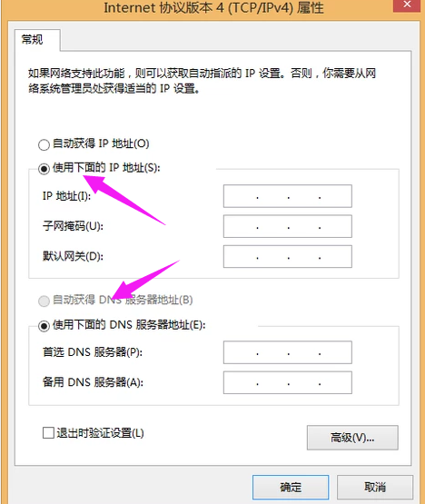 windows本地连接受限制或无连接如何解决